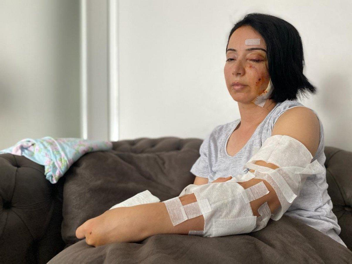 Samsun’da yasaklı ırk köpekler, anne ve 4 yaşındaki kızına saldırdı