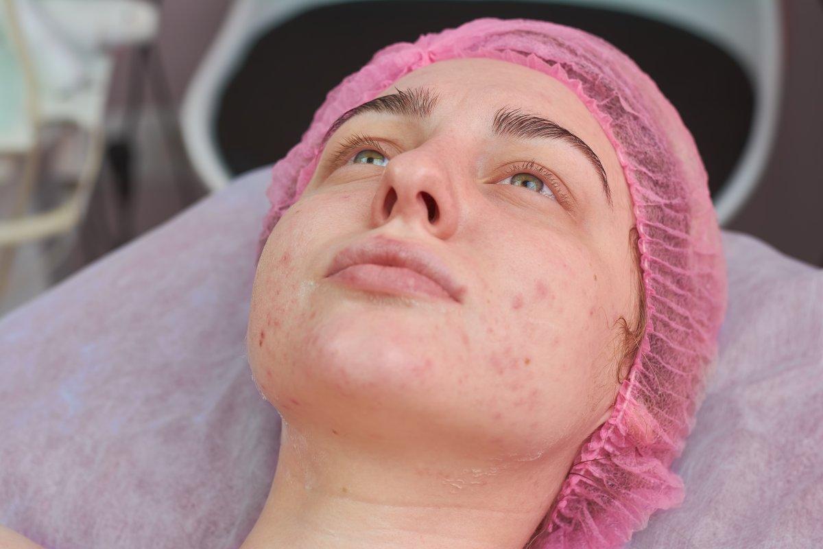 Yüzde ortaya çıkan 10 tehlikeli hastalık