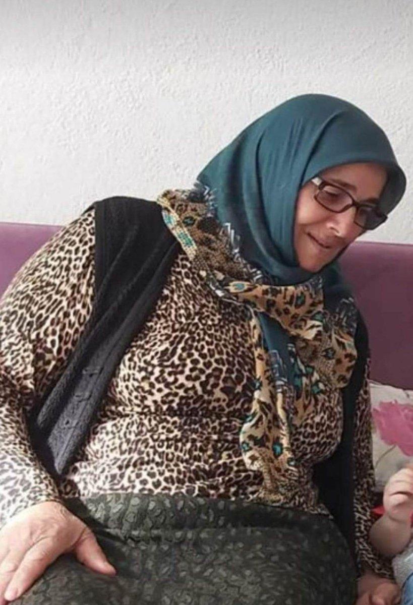 Karaman’da köpek saldırısına uğrayan kadın öldü