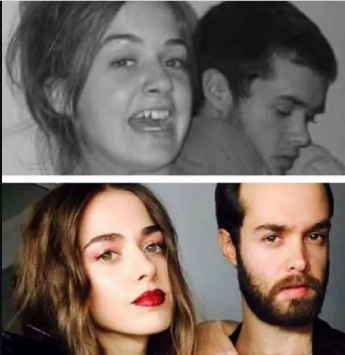 Bensu Soral estetik yaptırdı