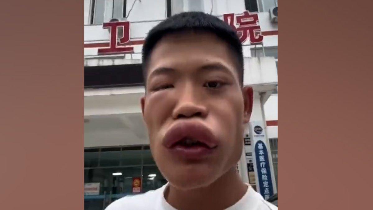 Çinli fenomen yaban arısı yedi