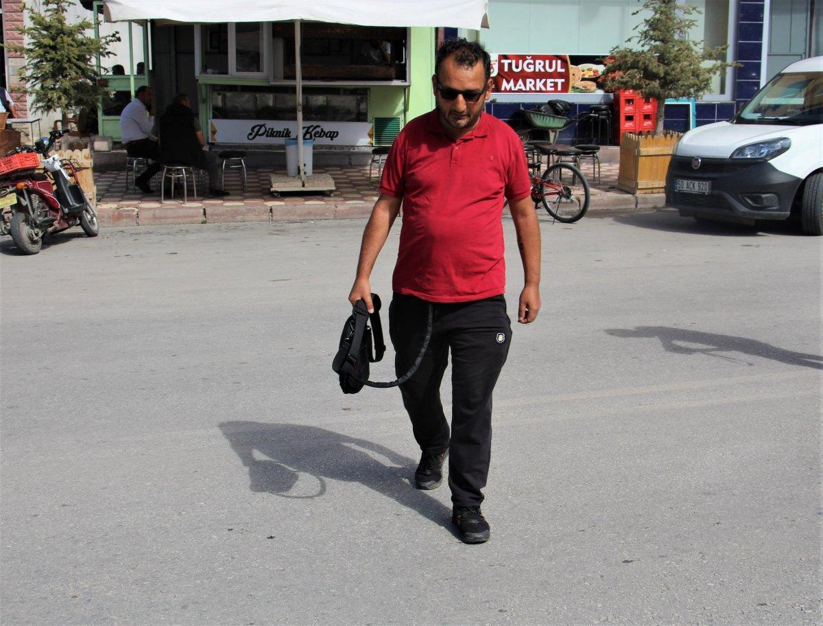 Sivas'ta yapay kalple yaşayan adam: Çantamı para dolu zannediyorlar