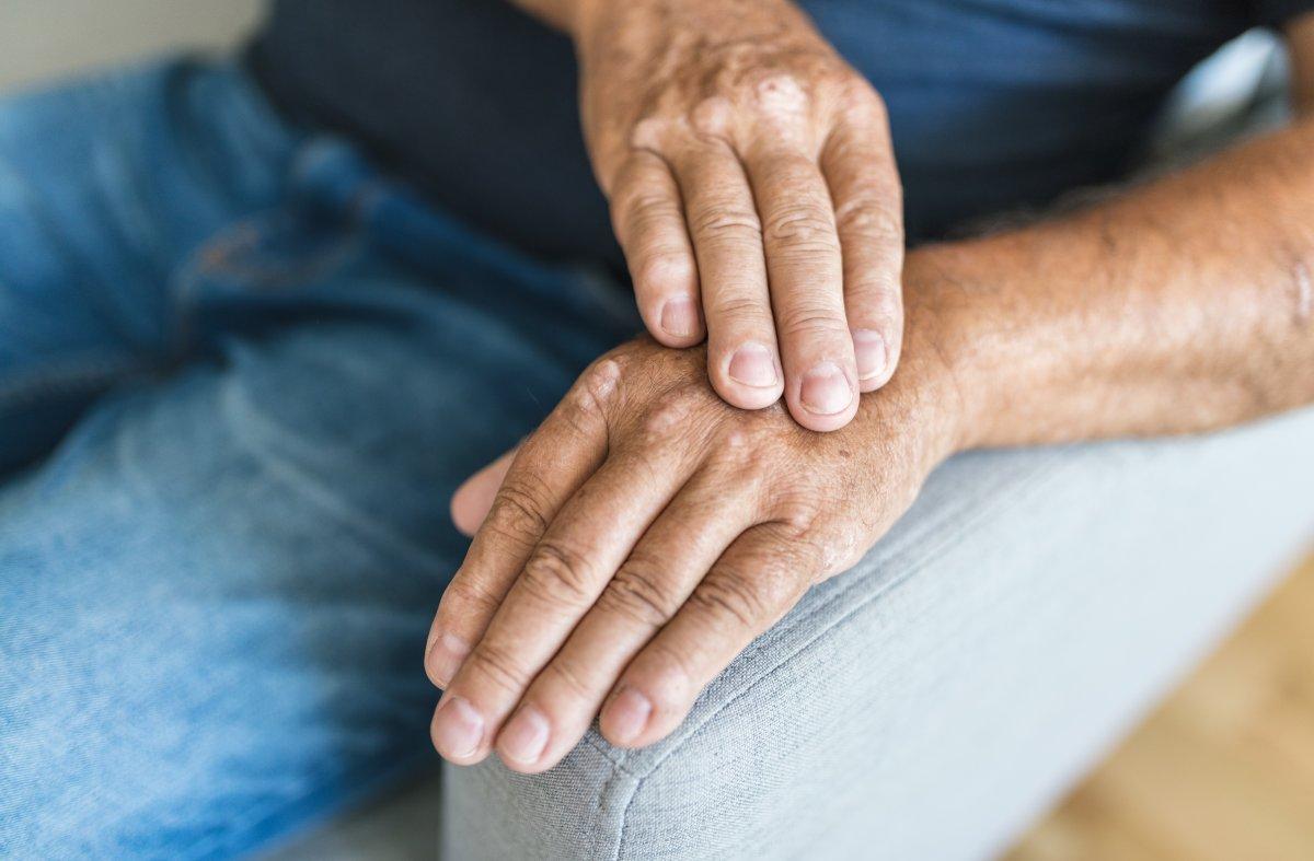 Birçok hastalığın belirtisi! Avuç içi kaşıntısının en yaygın 6 nedeni