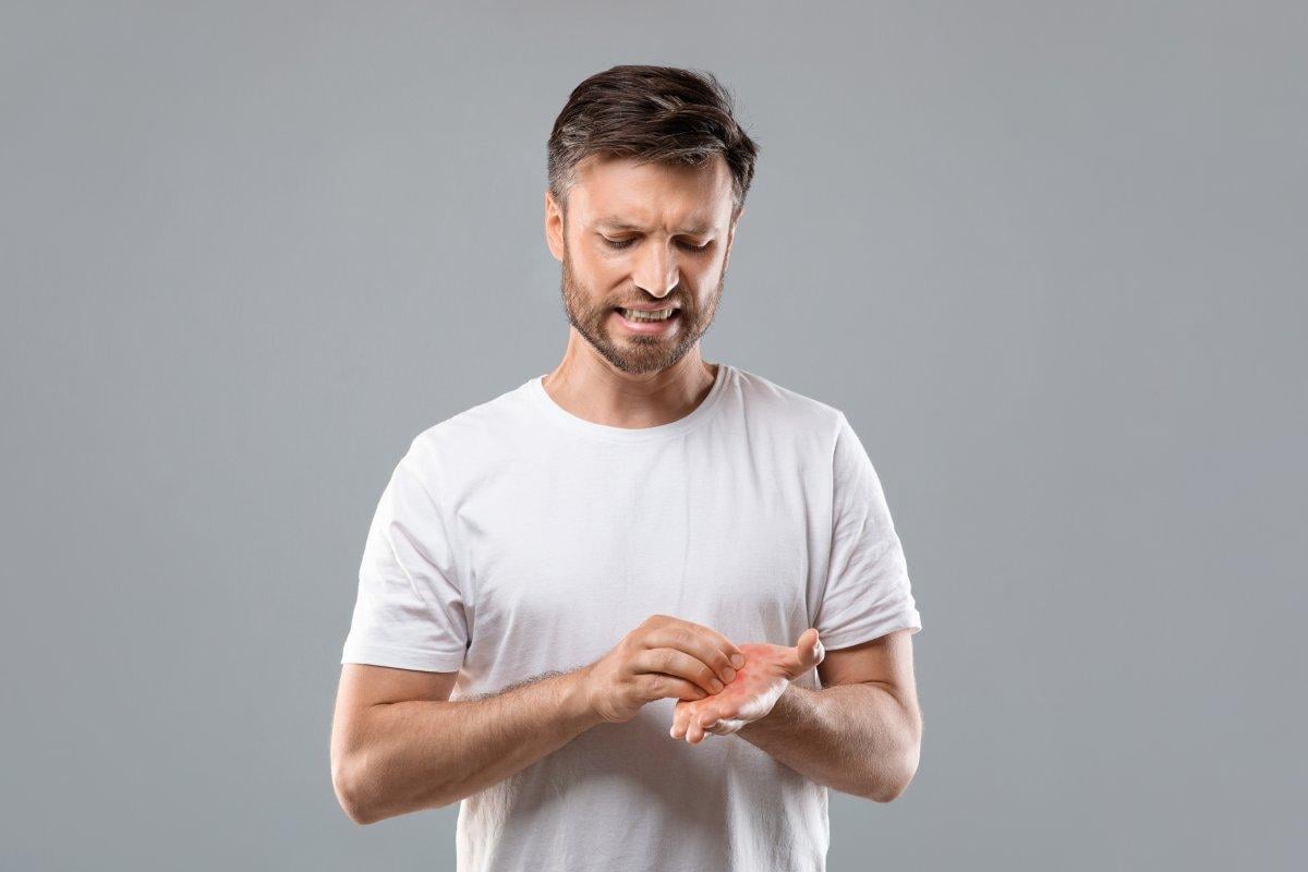 Birçok hastalığın belirtisi! Avuç içi kaşıntısının en yaygın 6 nedeni