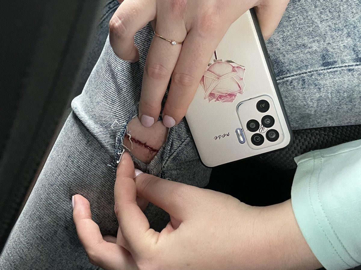 Başıboş sokak köpekleri İstanbul'da turistlere saldırdı