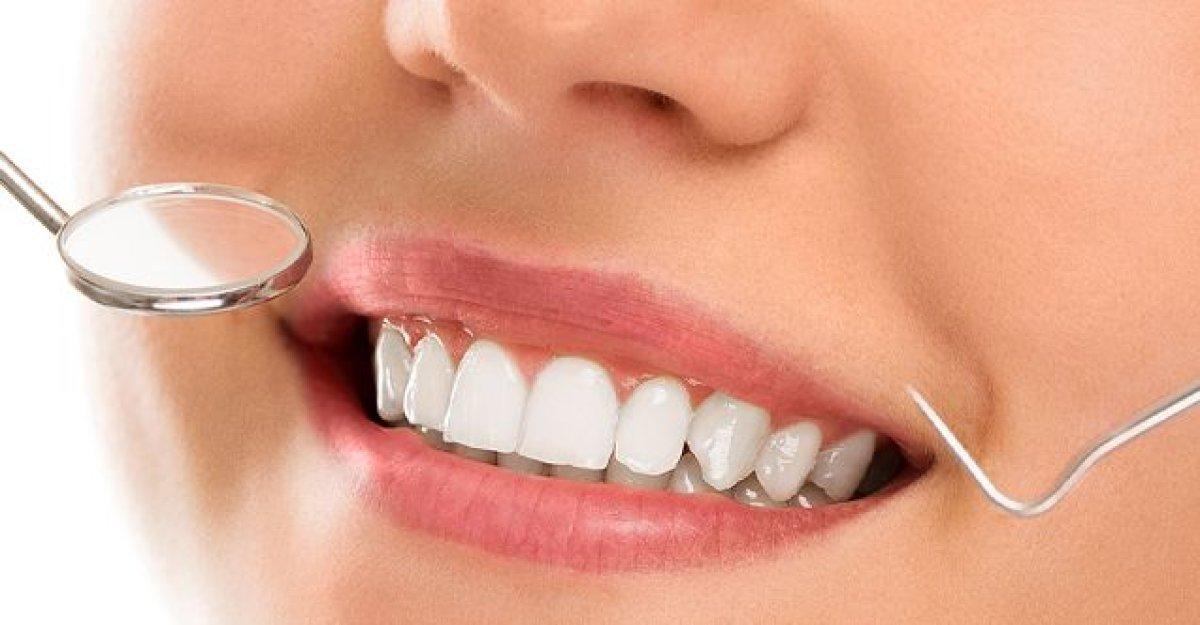 Hollywood gülüşü nedir, nasıl sahip olunur? İşte diş sağlığı için yapılması gerekenler!