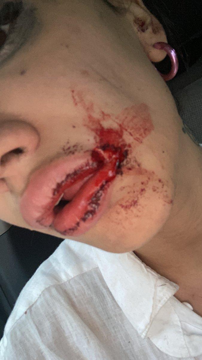 Kağıthane'de, laf attığı kardeşleri darbeden saldırgan tutuklandı