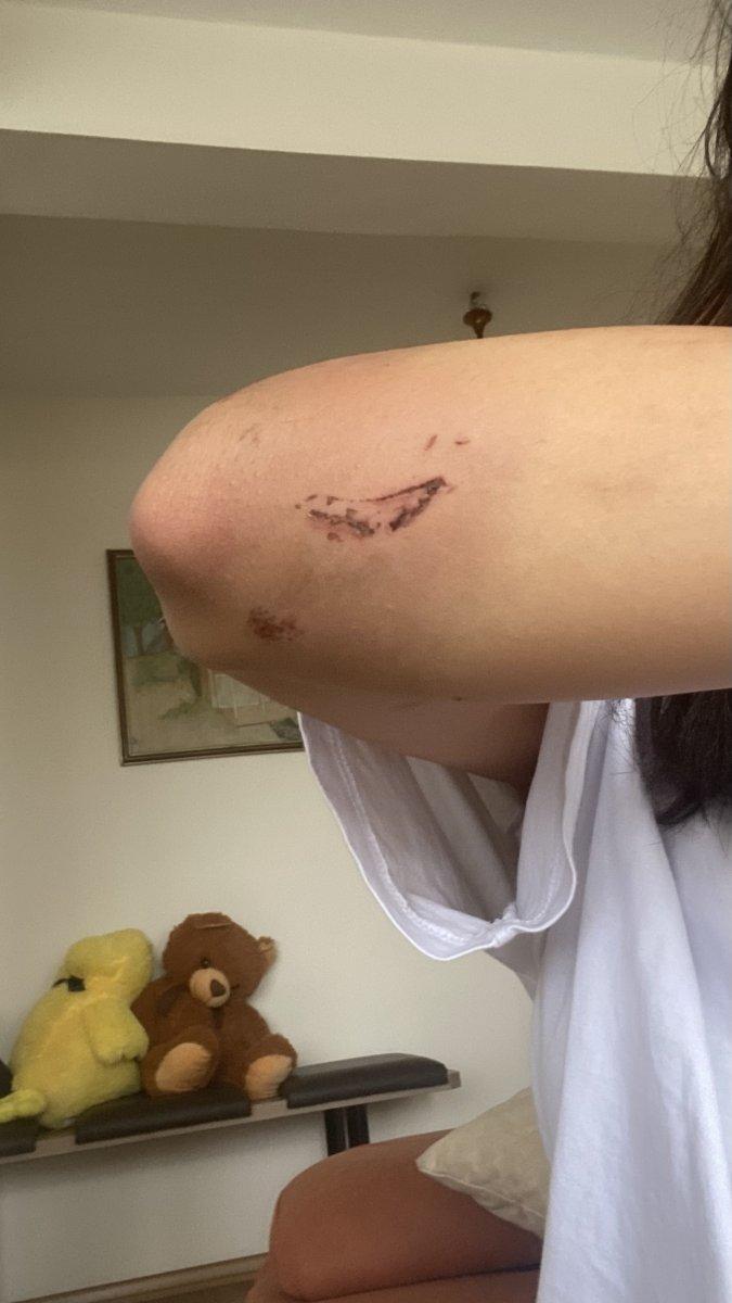 Kağıthane'de, laf attığı kardeşleri darbeden saldırgan tutuklandı