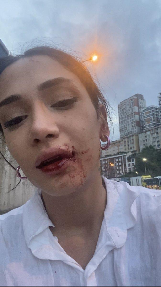 Kağıthane'de, laf attığı kardeşleri darbeden saldırgan tutuklandı