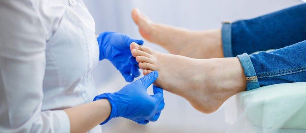 Tırnak mantarına ilaç gibi tavsiye: Bu doğal kürle mantara veda edin!