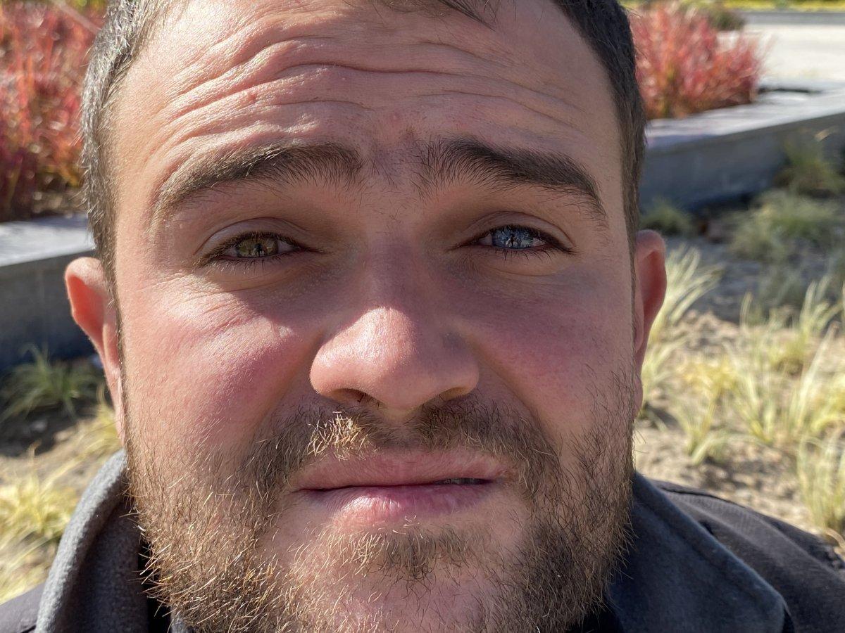 Görenler şaşırıp kalıyor: Bir gözü mavi diğeri ise yeşil