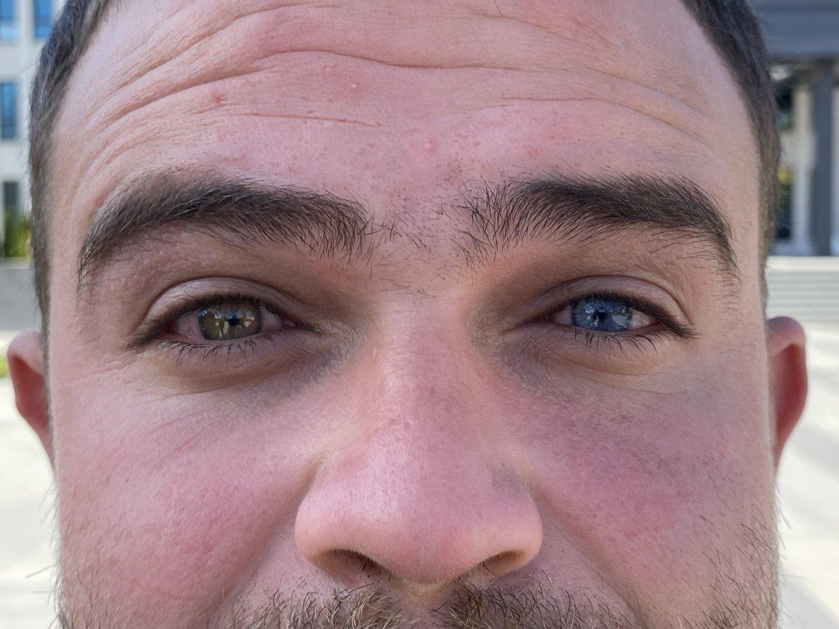 Görenler şaşırıp kalıyor: Bir gözü mavi diğeri ise yeşil