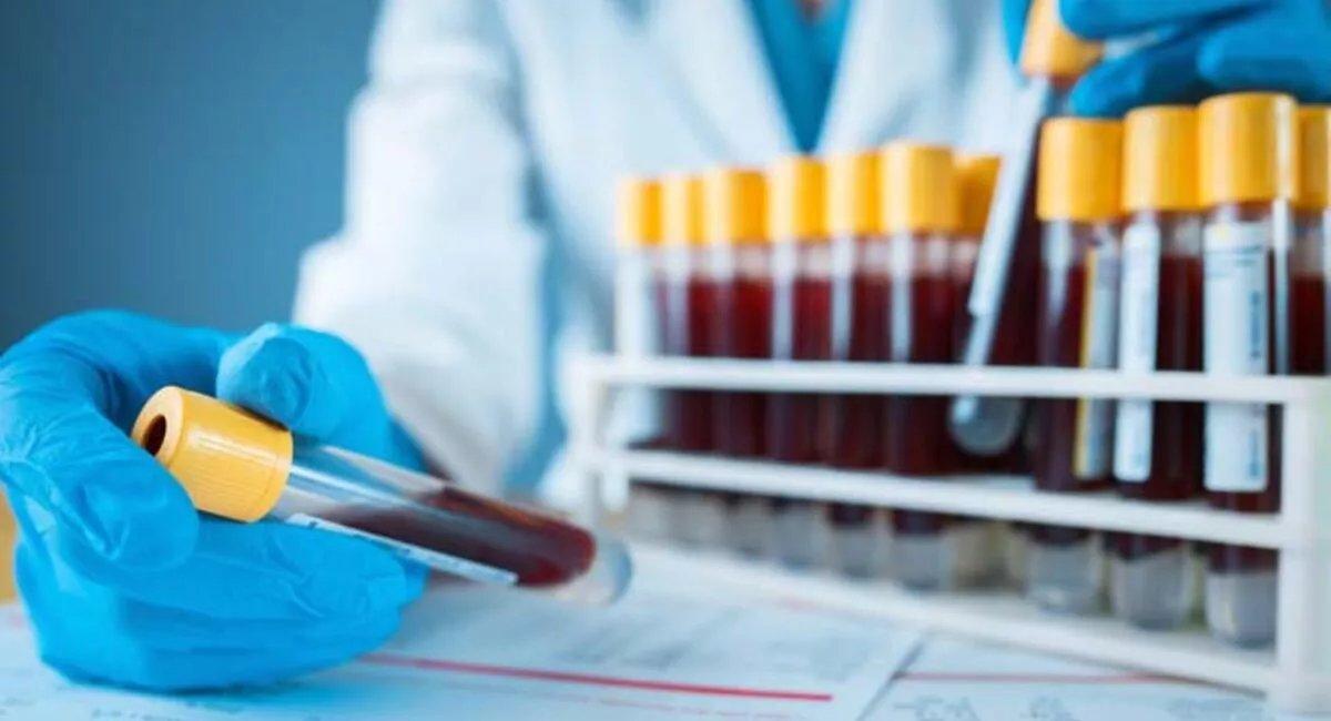 Laboratuvar kanı ilk kez bir insana nakledildi