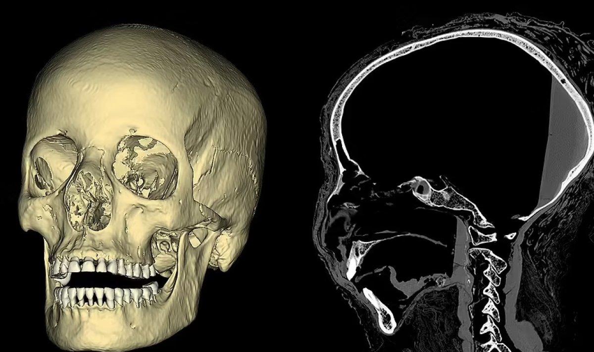 Dünyanın ilk hamile antik Mısır mumyasının yüzü yeniden canlandırıldı