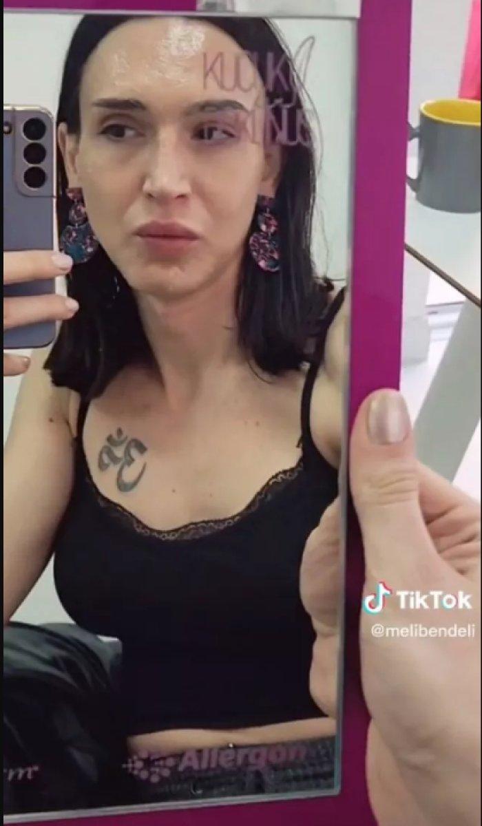 Çukur'un Timsah Celil'i dolgu yaptırdı