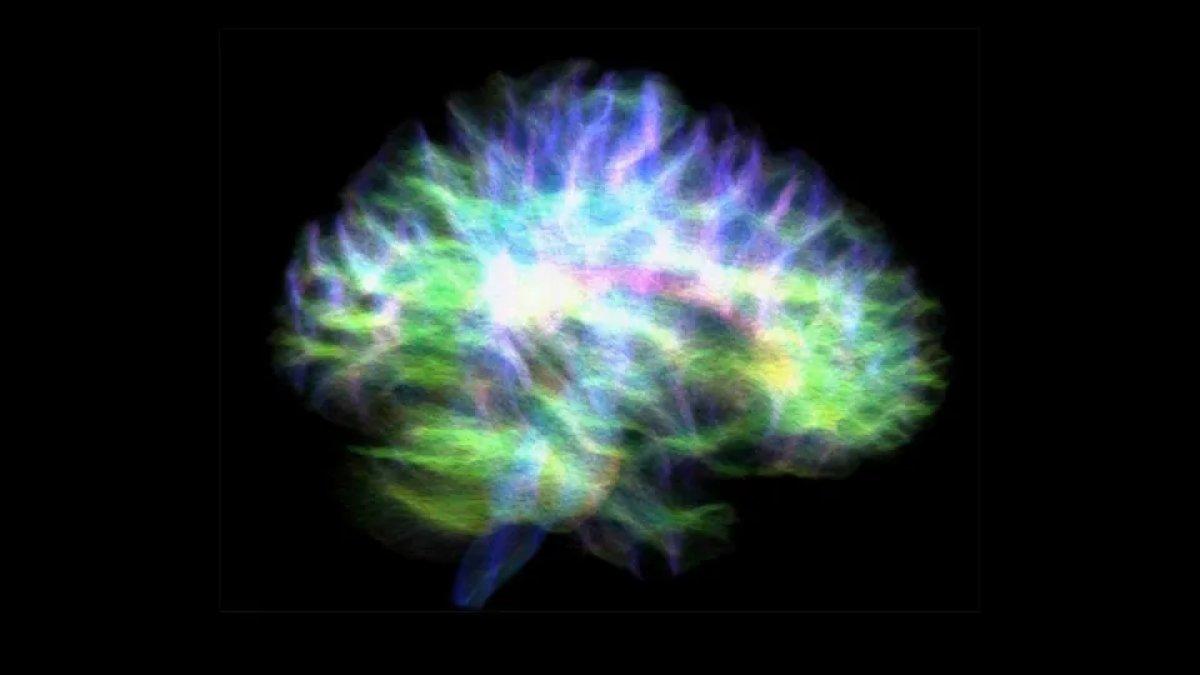 Sinir yollarının en ayrıntılı haritası oluşturuldu