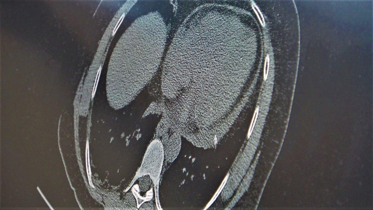 Profesör açıkladı: Maskeye dönmenin zamanı geldi