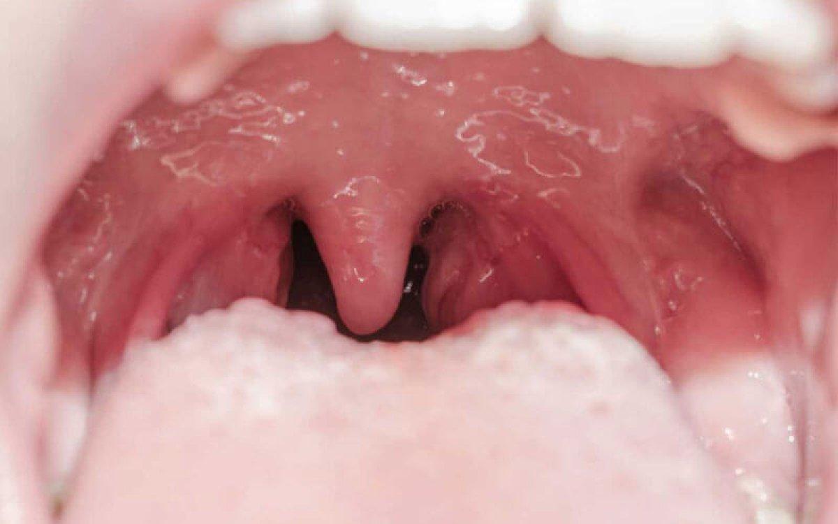 İyi ki var: Küçük dilimiz ne işe yarar