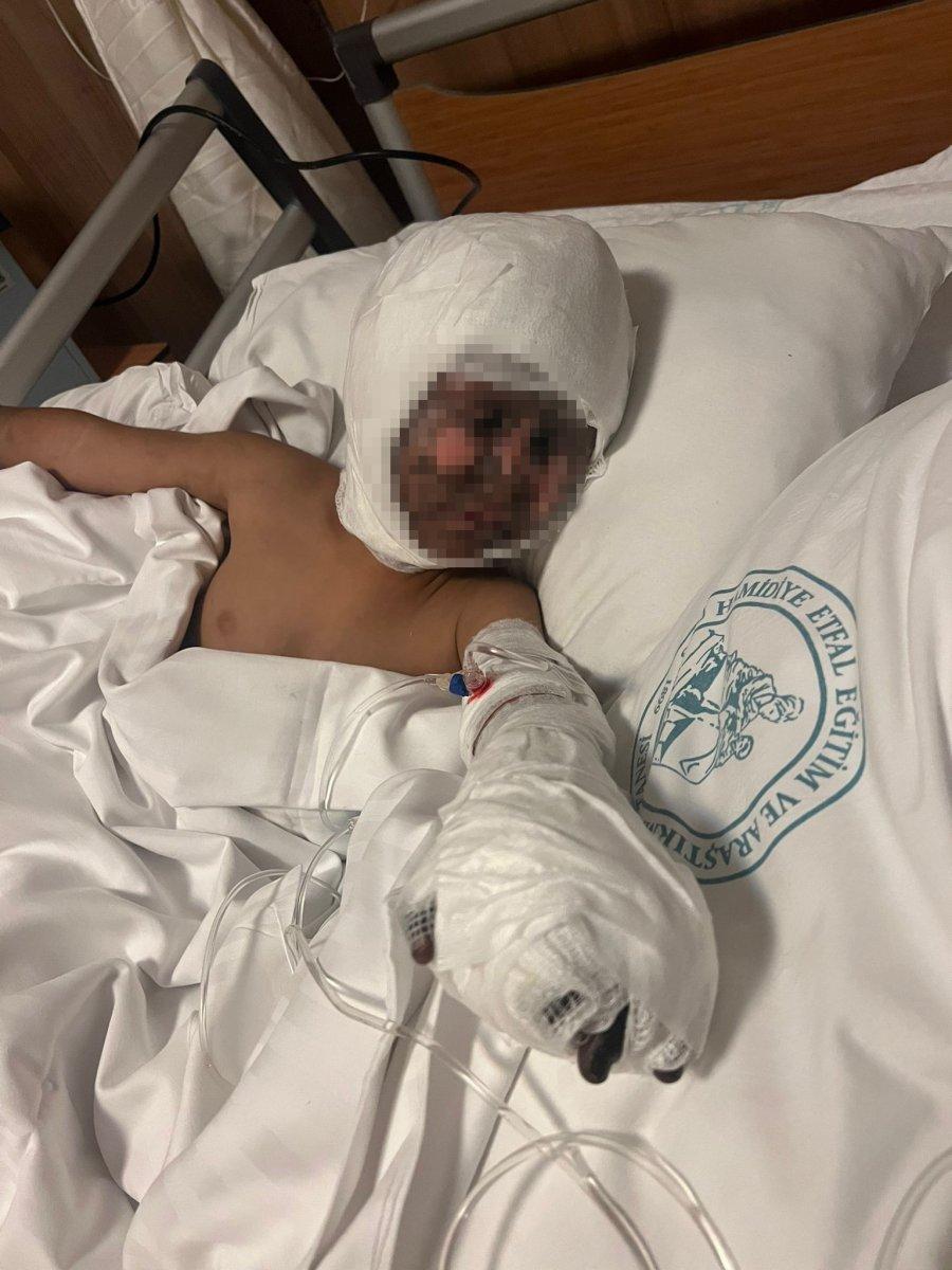 Esenyurt’ta elektrik trafosuna çatal sokan çocuk yandı