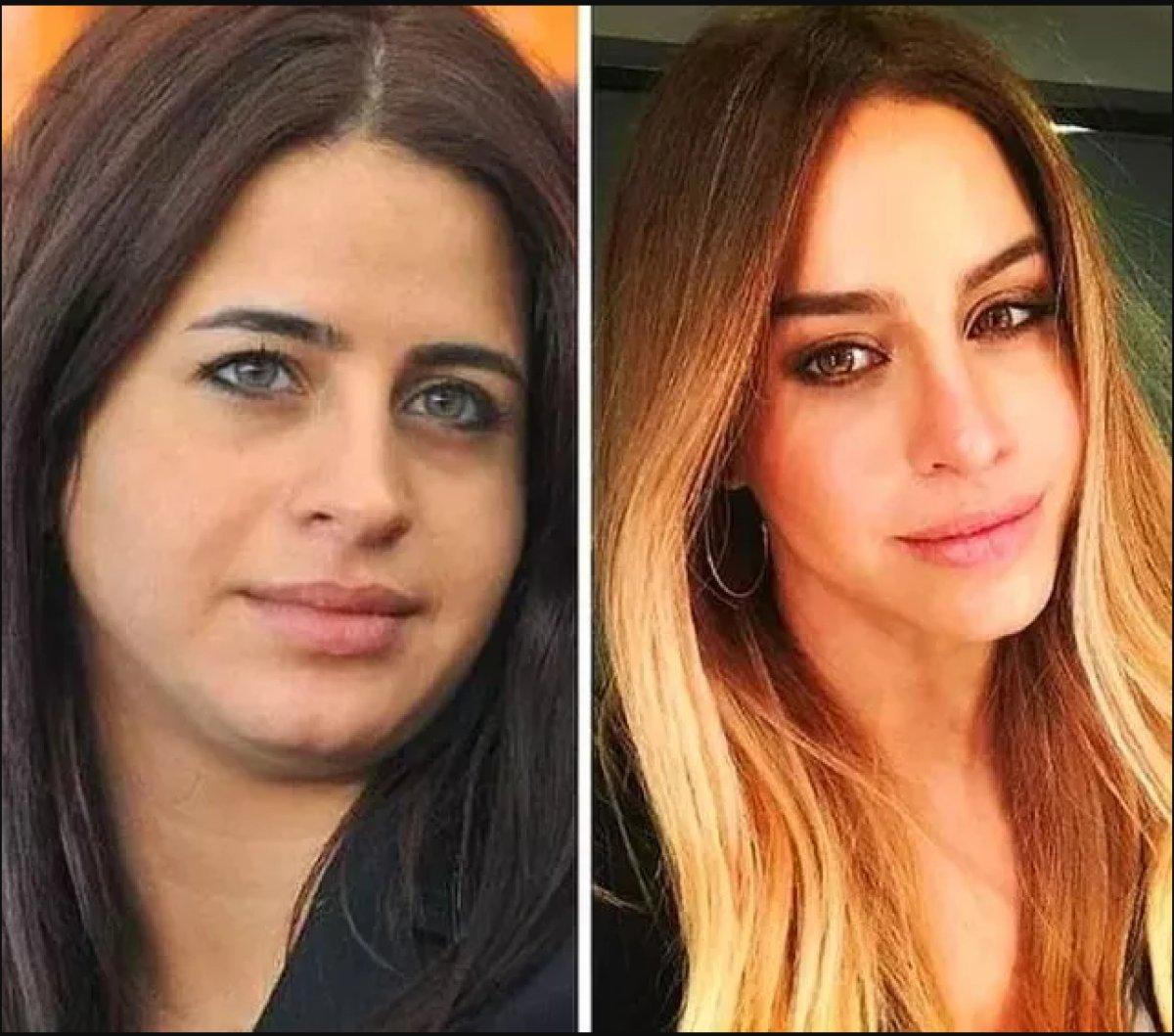 Büşra Pekin'in estetik faturası