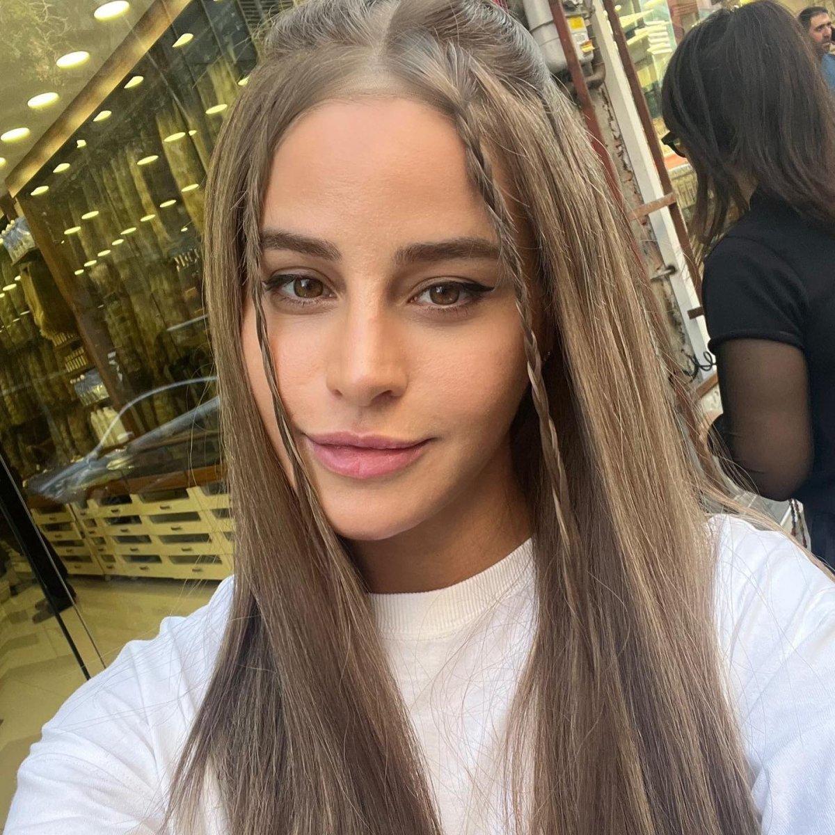 Büşra Pekin'in estetik faturası