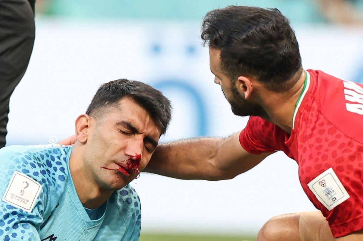İranlı Hosseini ve Beiranvand çarpıştı