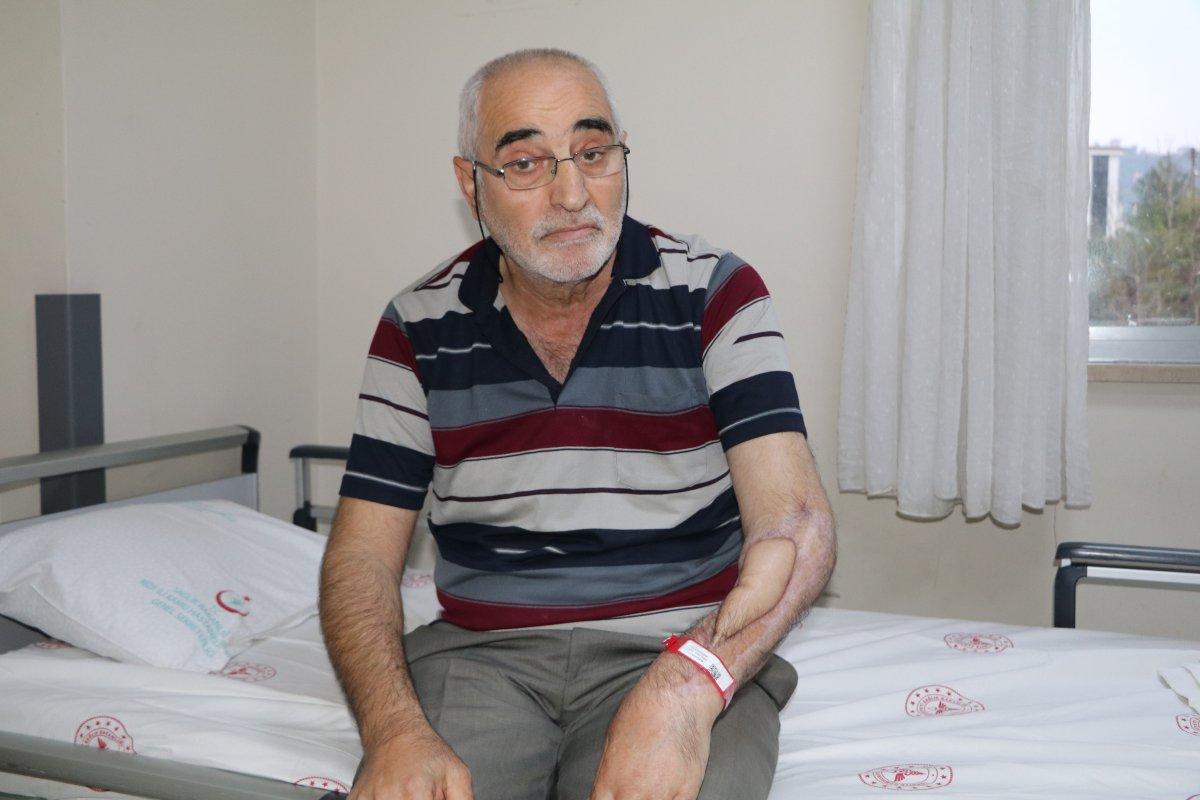 17 kez ameliyat oldu, çürüyen kolu doku nakli ile kurtuldu