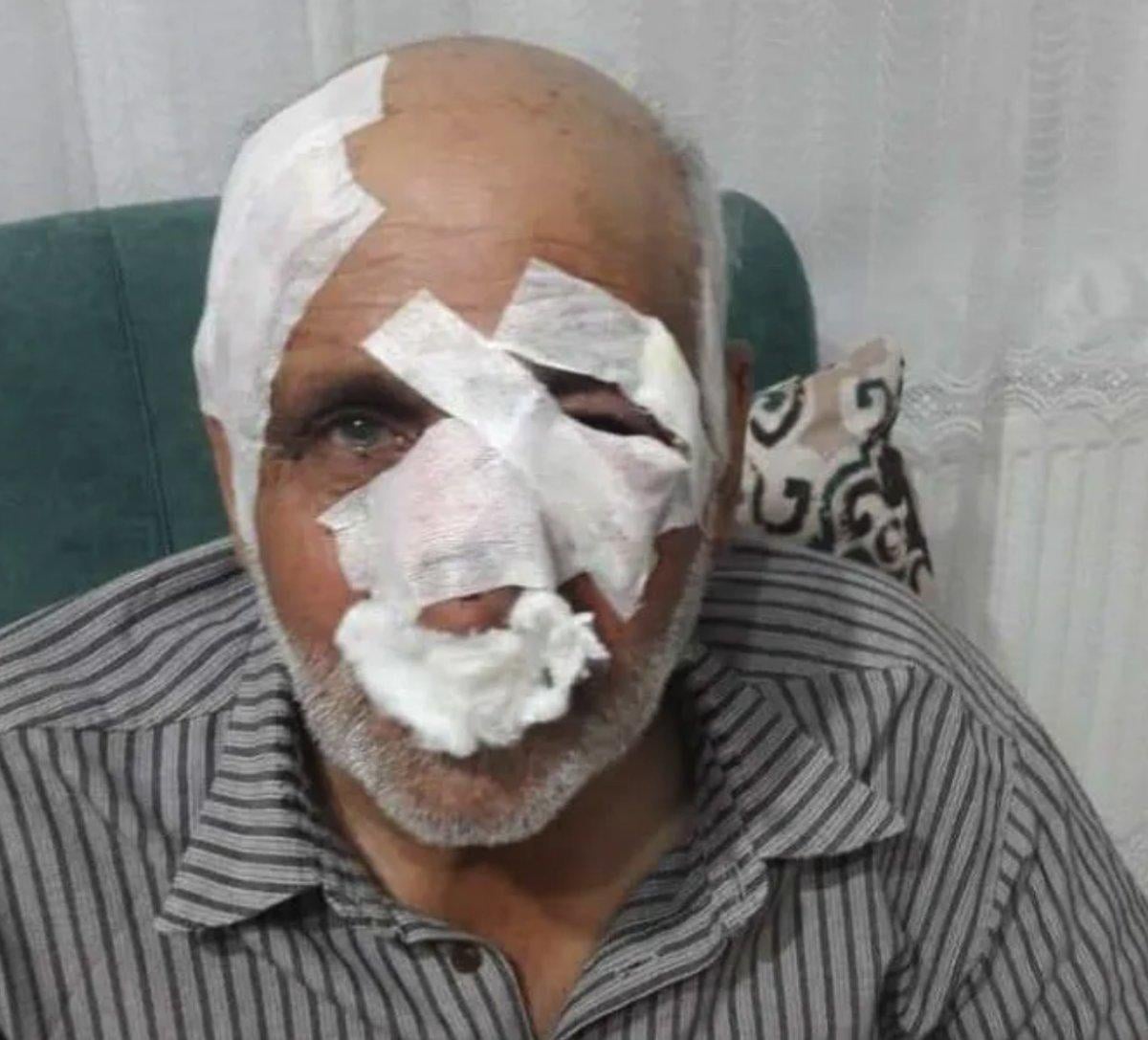 Sokak köpekleri yüzünden daha kaç çocuk hayatını kaybedecek