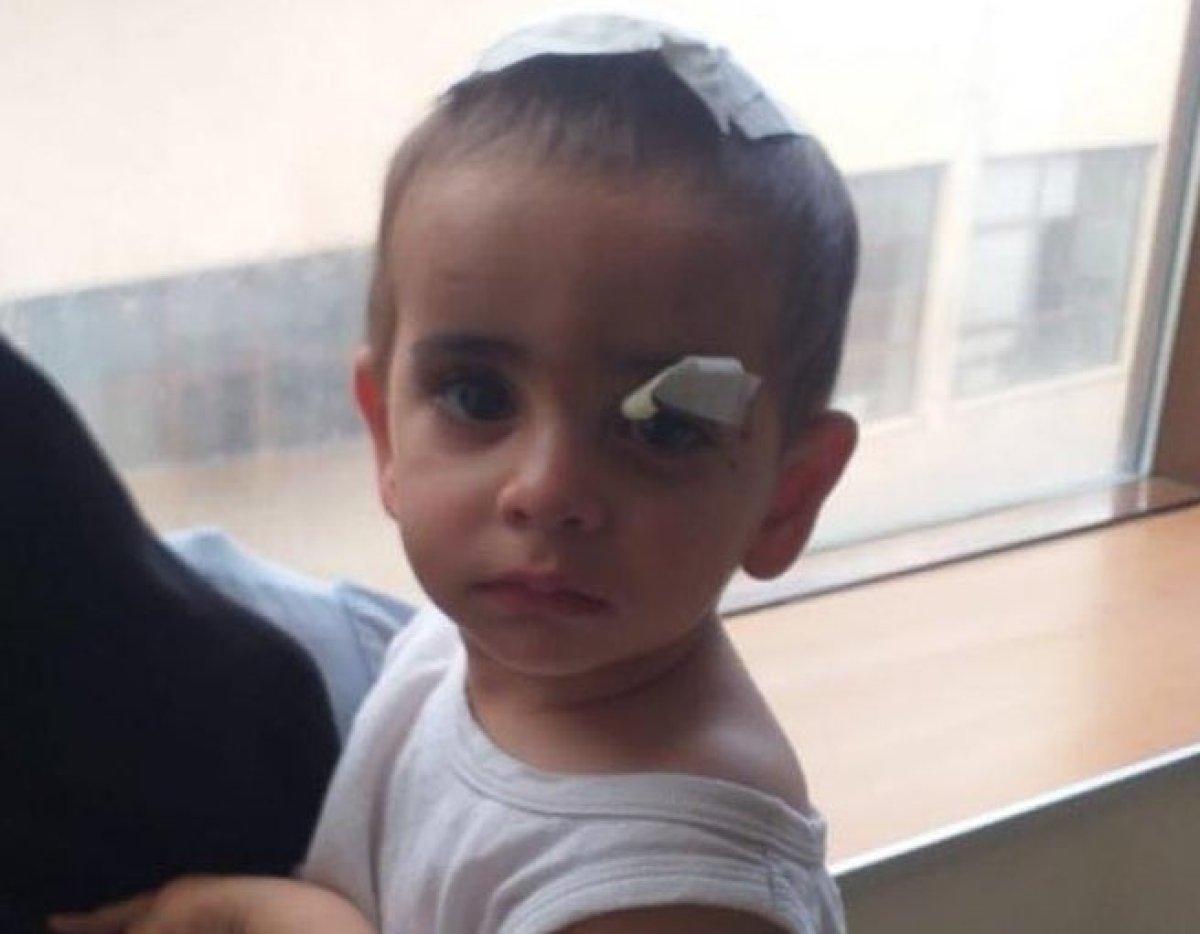 Sokak köpekleri saldırısında acı bilanço 