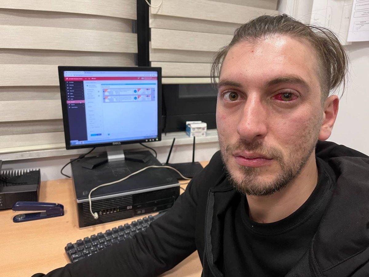 Esenyurt'ta ilk yardıma giden sağlık çalışanı saldırıya uğradı 