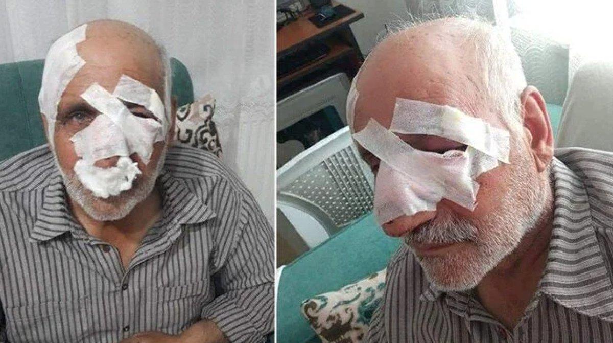 Sokak köpekleri saldırısında acı bilanço 