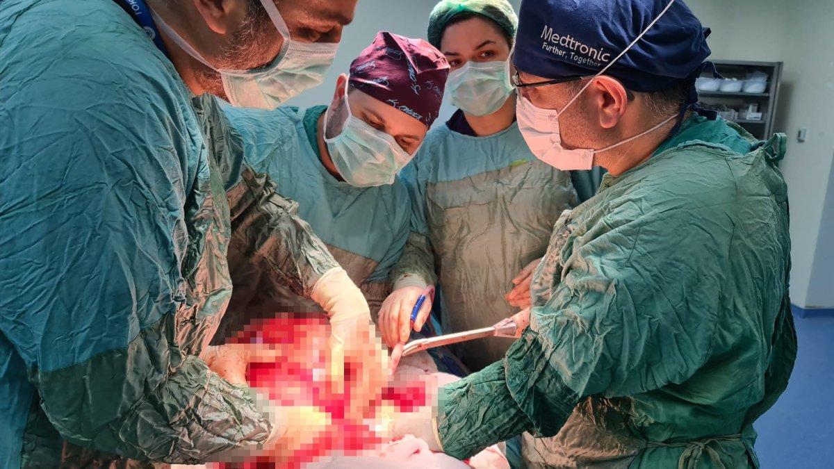 Tokat'ta, hastanın karnından 13 kilogram kitle çıktı