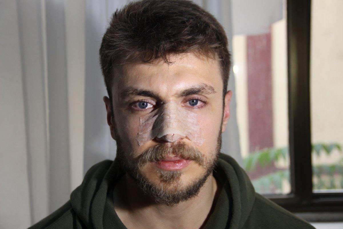 İzmir'de 'Eşimi nasıl muayene edersin' diyerek doktorun burnu kırdı