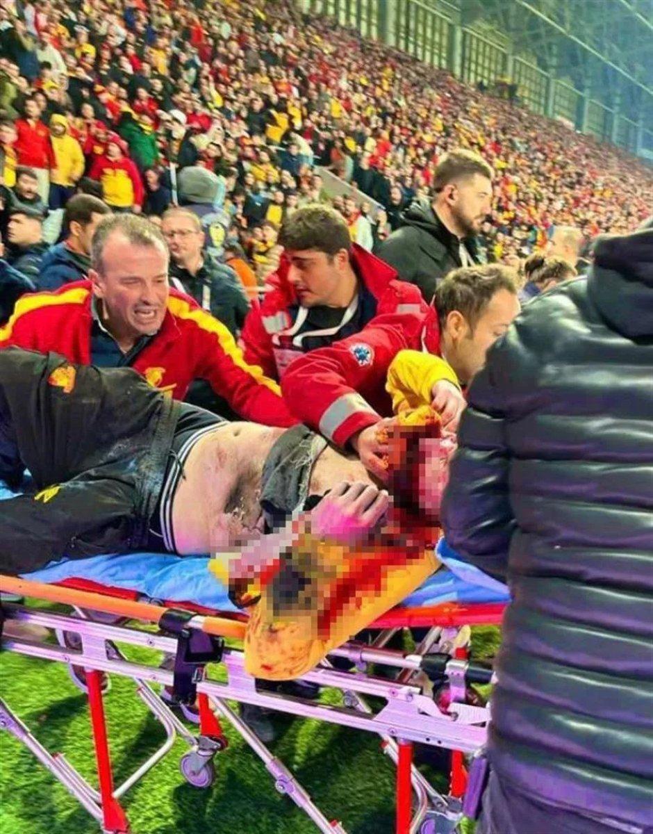 İzmir'de trübünde yaralanan taraftar yoğun bakımdan çıktı