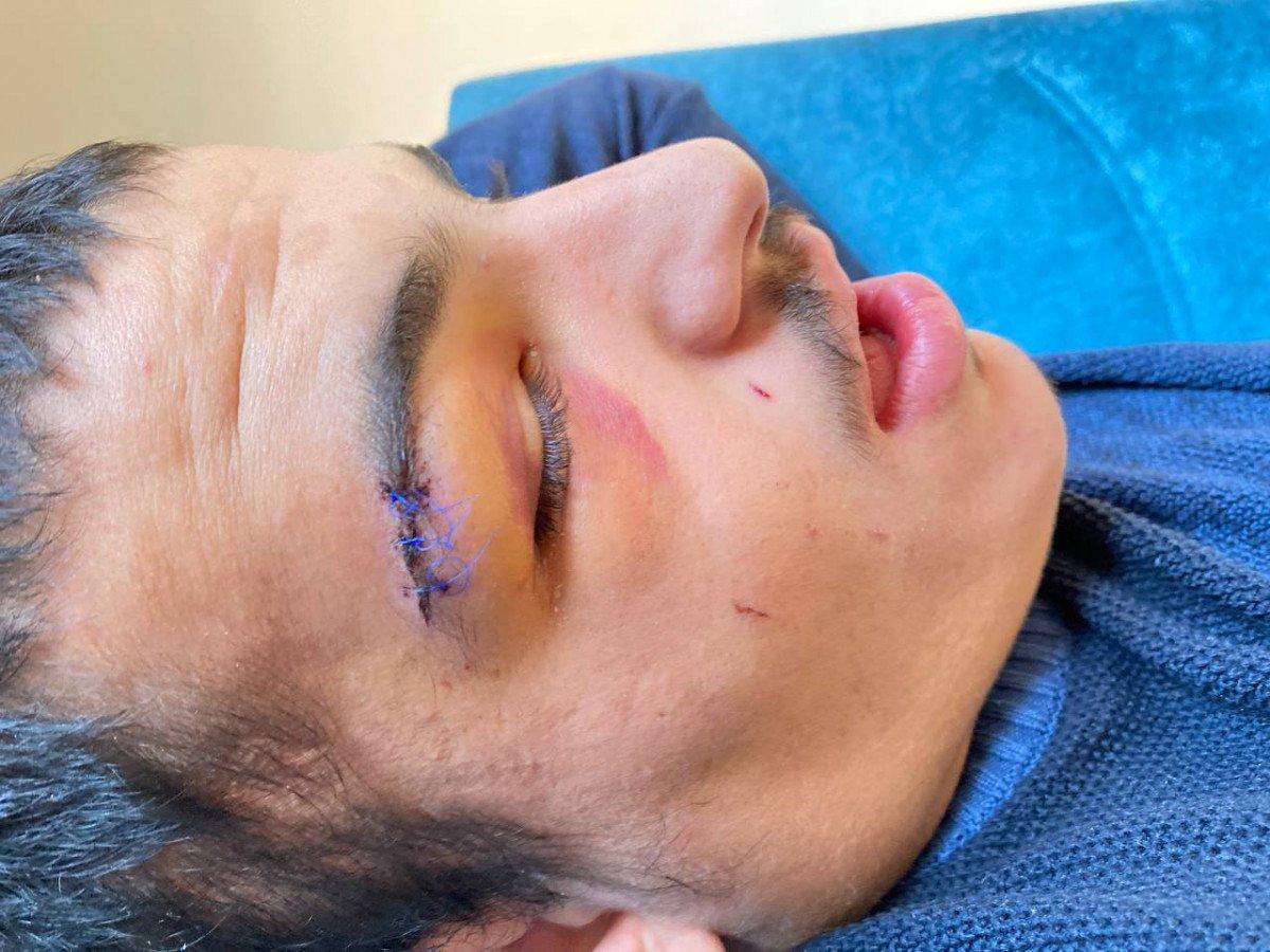 Diyarbakır'da 'otizmli genç tavukları sevdi diye dayak yedi' iddiası