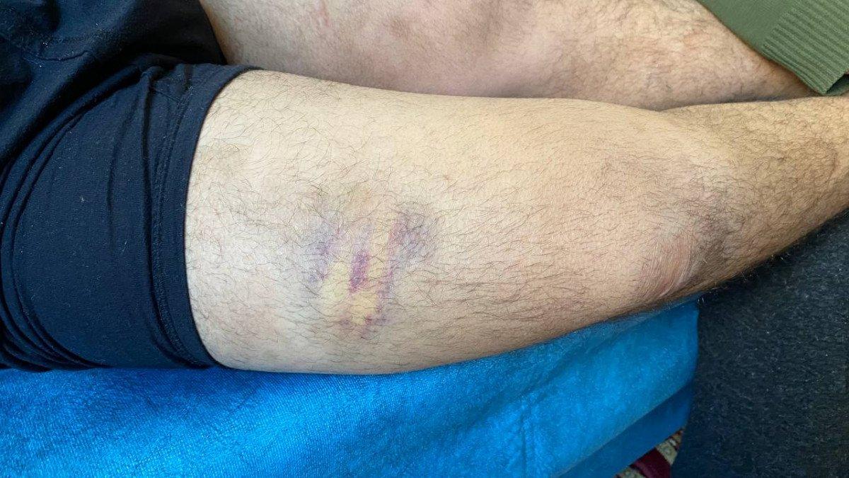 Diyarbakır'da 'otizmli genç tavukları sevdi diye dayak yedi' iddiası