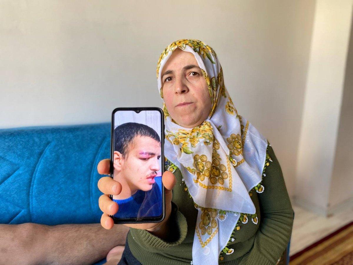 Diyarbakır'da 'otizmli genç tavukları sevdi diye dayak yedi' iddiası