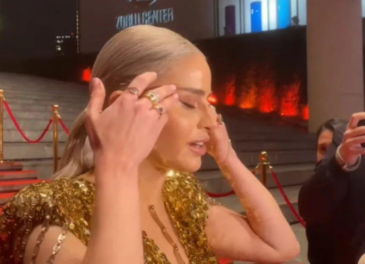 Büşra Pekin: Yüzümde bir tane estetik var