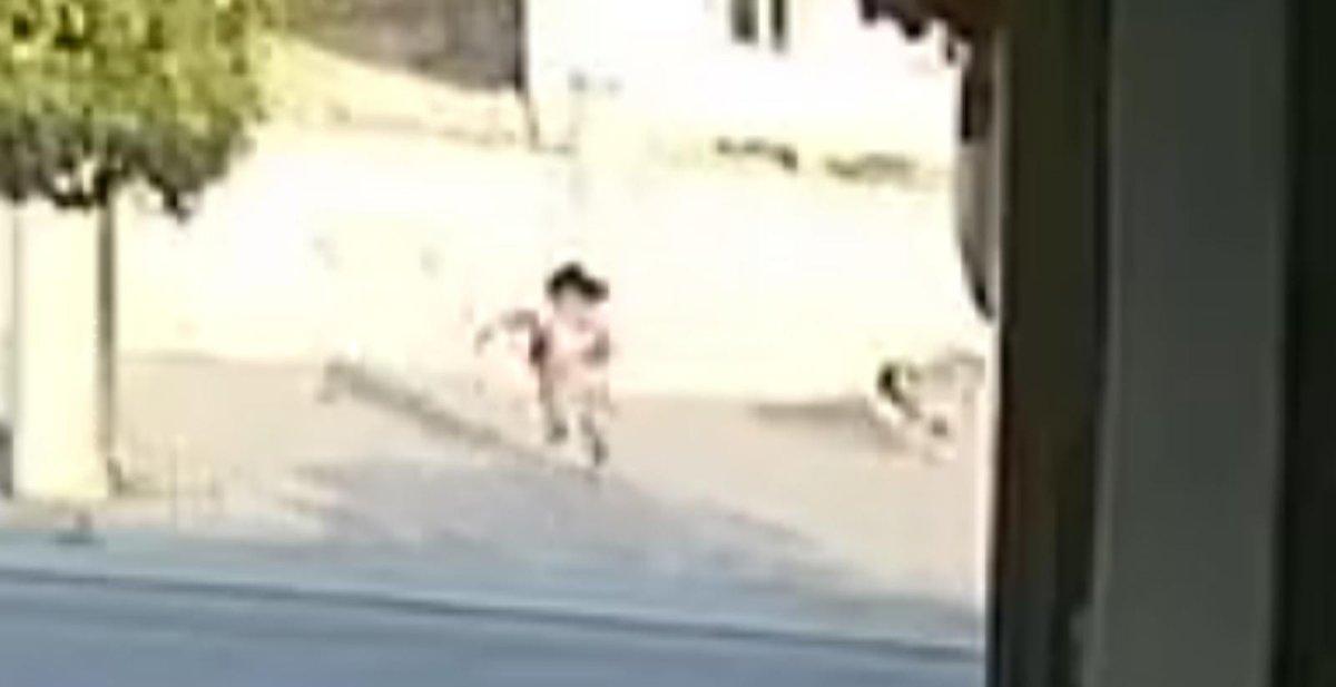 Şanlıurfa'da köpeklerin saldırdığı minik kız ölümden döndü