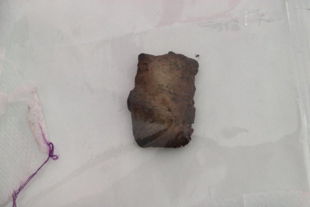 Ankara’daki şampiyonluk kutlamasında gözünü kaybetti, takipsizlik çıktı