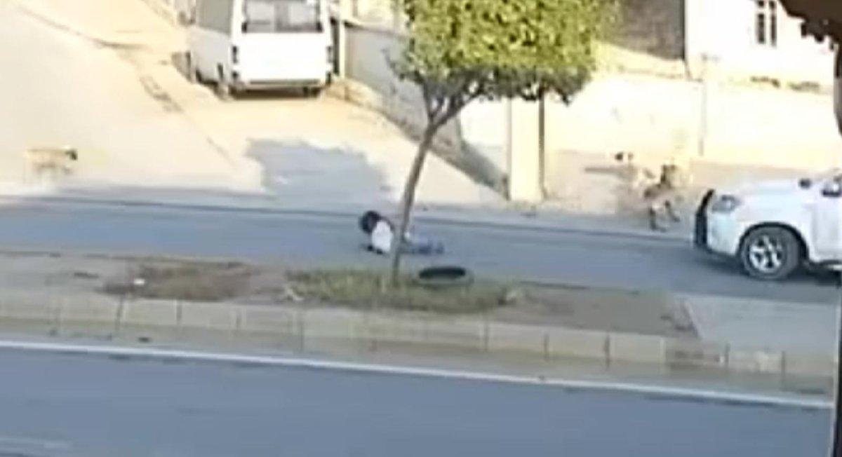 Şanlıurfa'da köpeklerin saldırdığı minik kız ölümden döndü