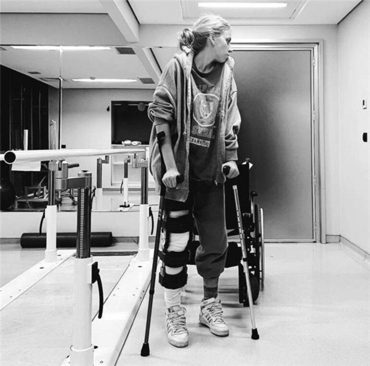 Melis İşiten ölümden döndüğü tarihi koluna kazıttı