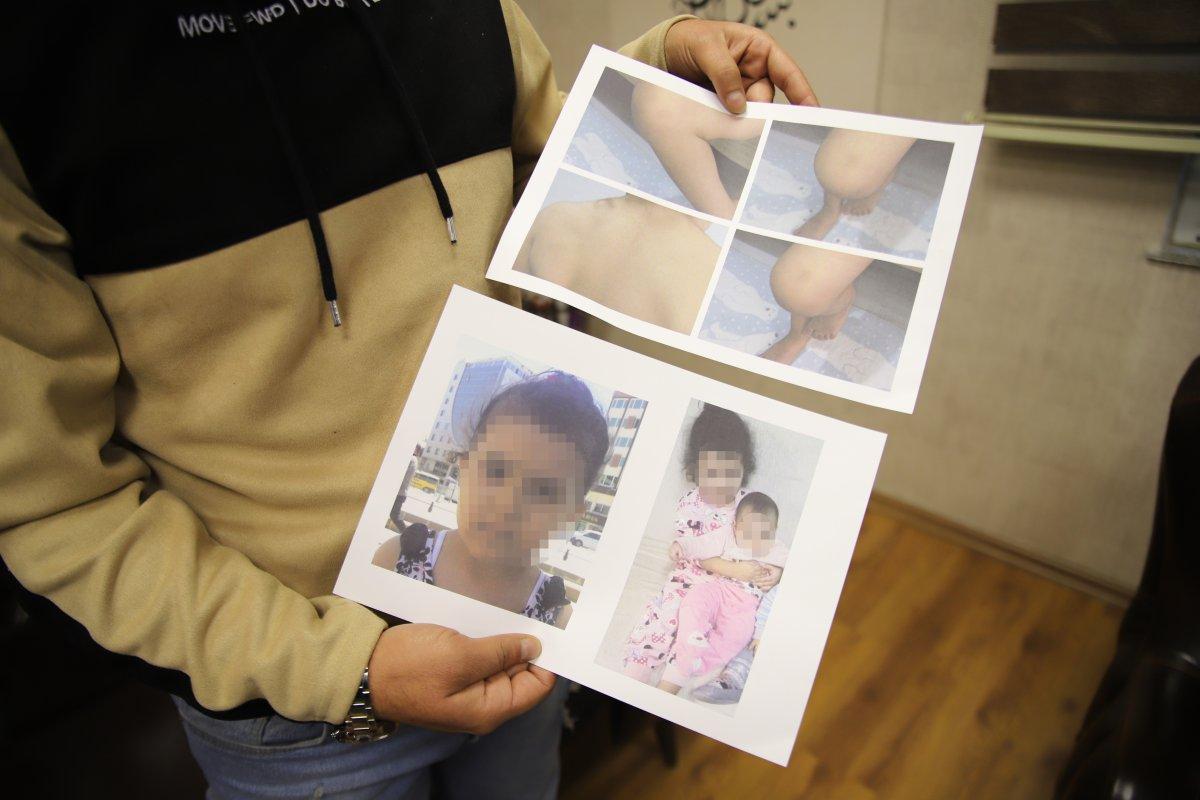 Gaziantepli babanın şok iddiası: Annesi bebeğimizi öldürdü