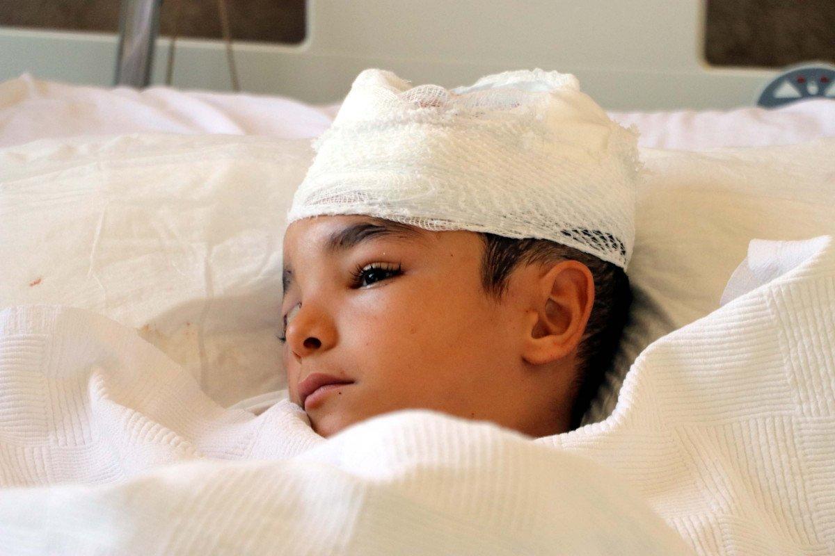 Gaziantep'te sokak köpeği küçük çocuğun kafa derisini koparttı