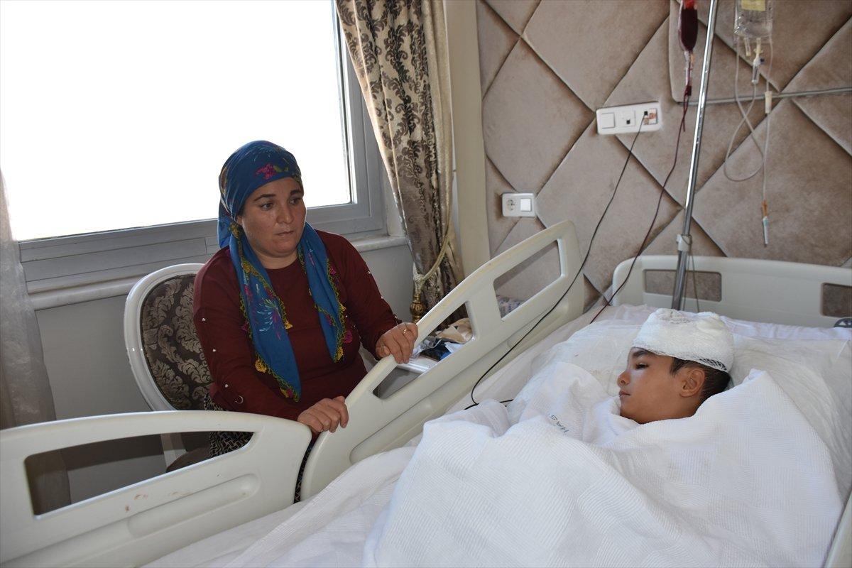 Gaziantep'te sokak köpeği küçük çocuğun kafa derisini koparttı