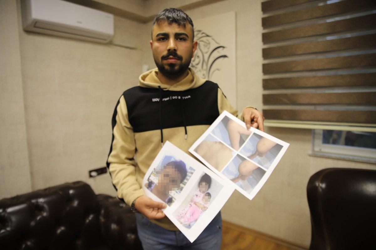 Gaziantepli babanın şok iddiası: Annesi bebeğimizi öldürdü