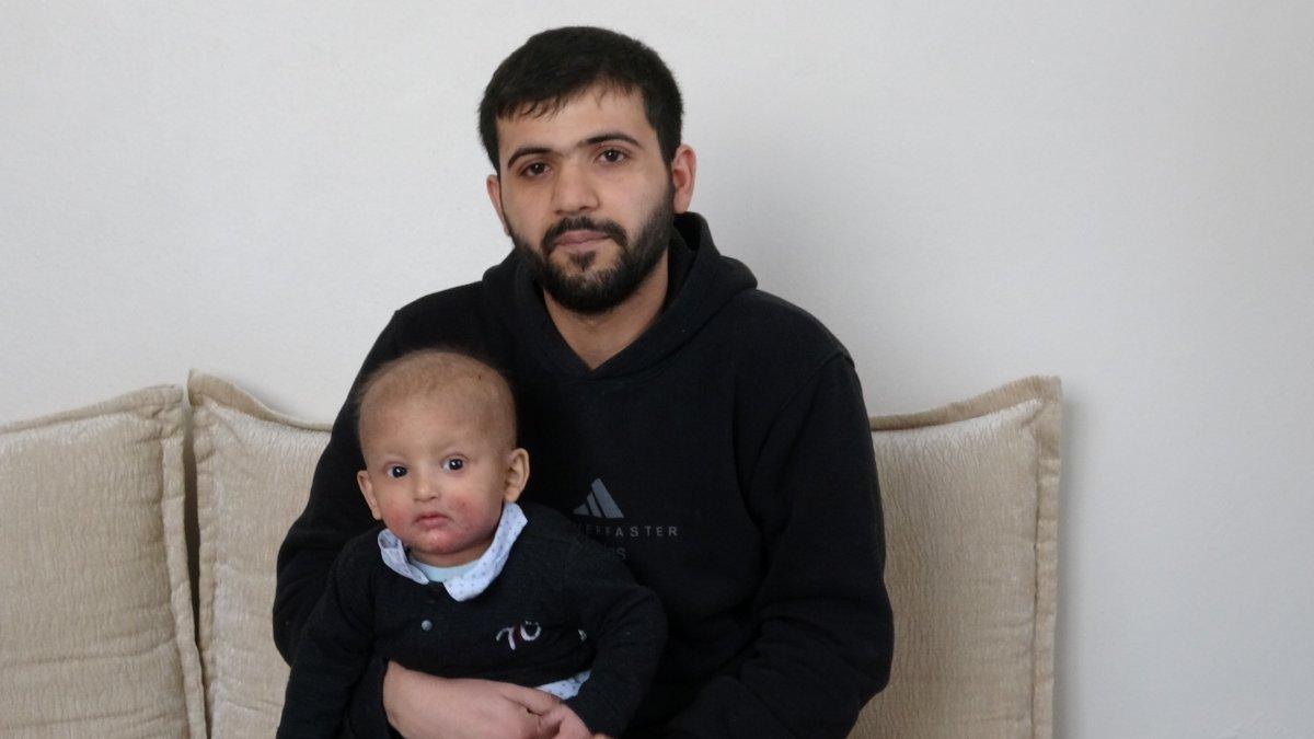 Mardin'de küçük çocuk, nadir görülen balık pulu hastalığıyla yaşıyor