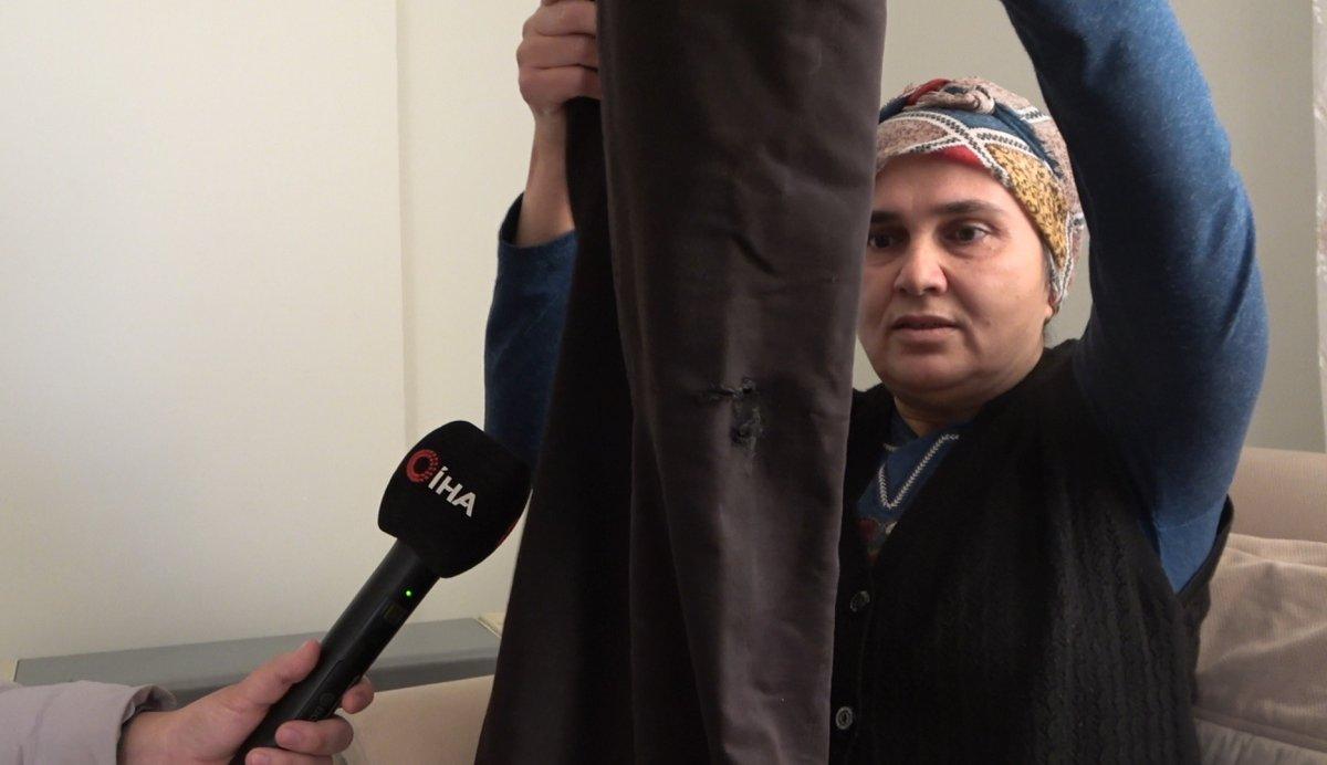 Osmaniye'de ekmek almaya giderken köpek saldırdı