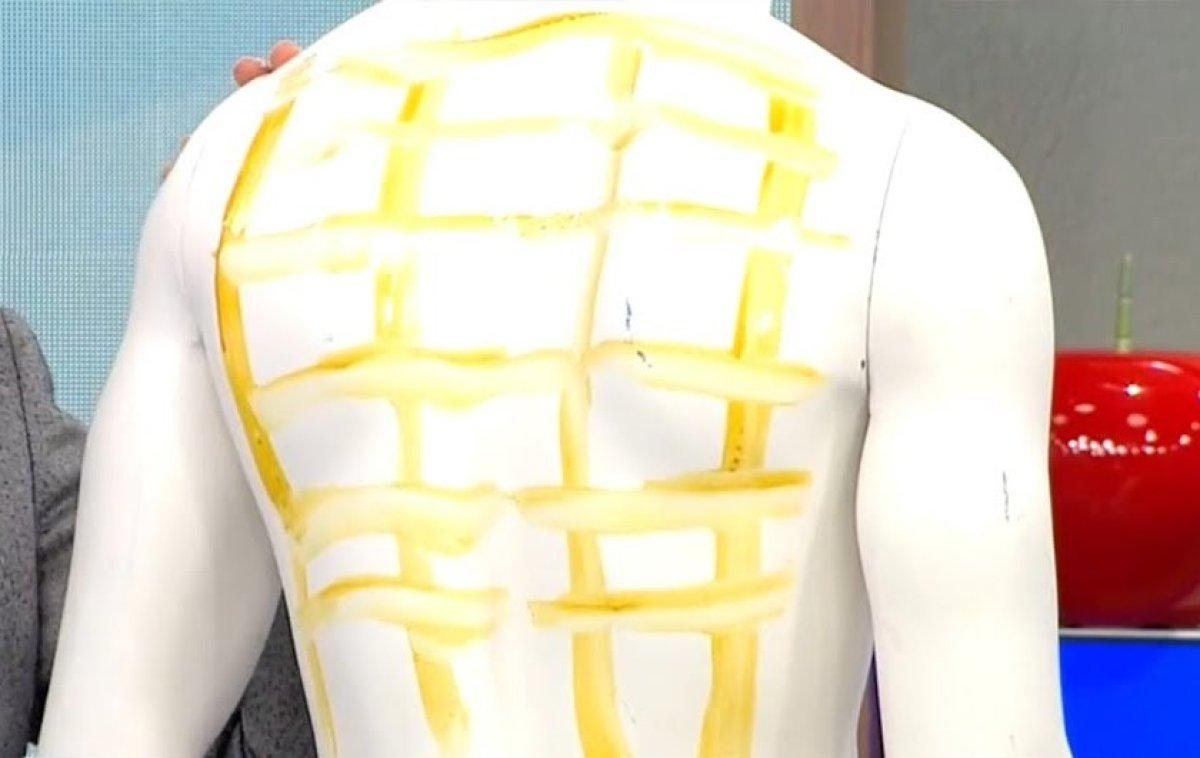 Sırta sürüldüğünde öksürük bitiyor: Tentürdiyot kafesi nasıl yapılır?