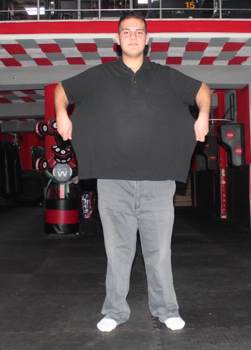 Manisa’da 19 yaşındaki genç 4 ayda 57 kilo verdi